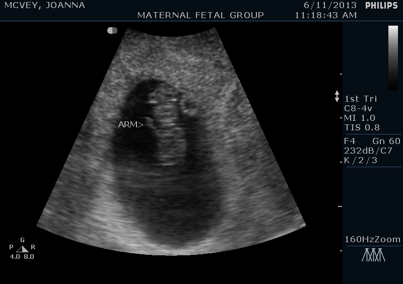 13-06-11-110414_MCVEY_20130611_110414_0001